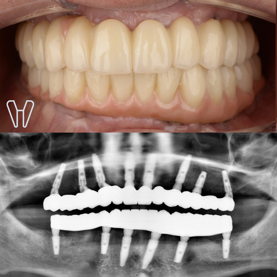 Після лікування