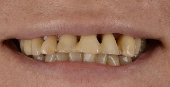 До лікування