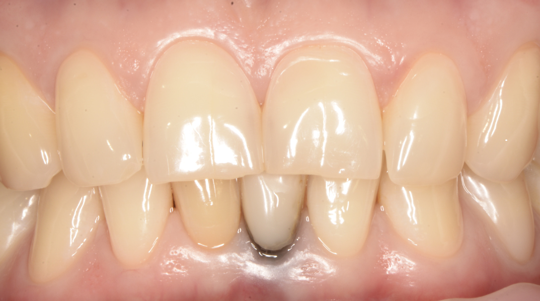 До лікування