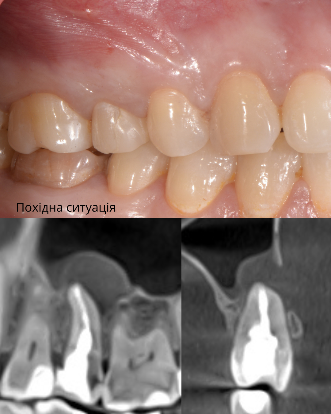 До лікування
