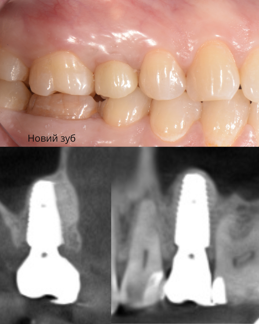 Після лікування
