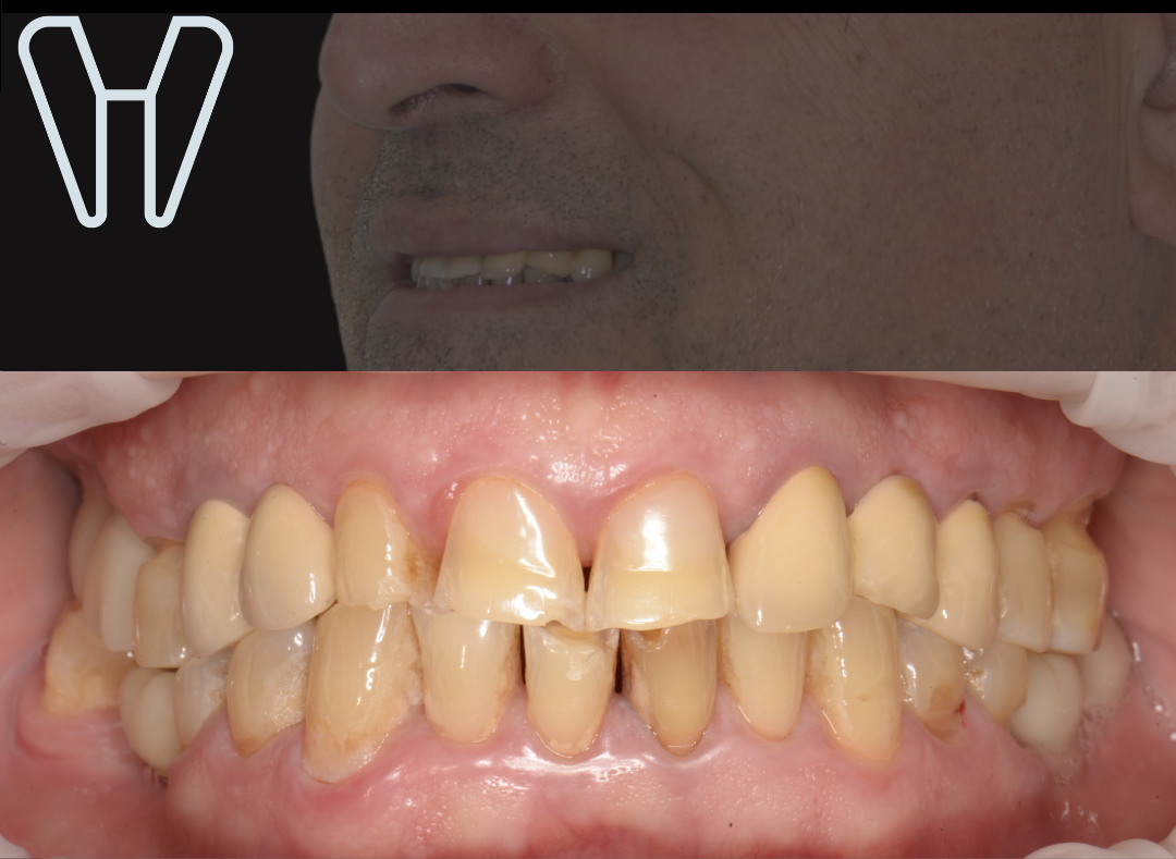 До лікування