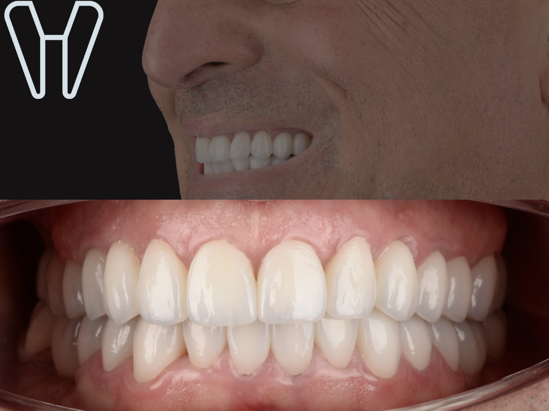 Після лікування