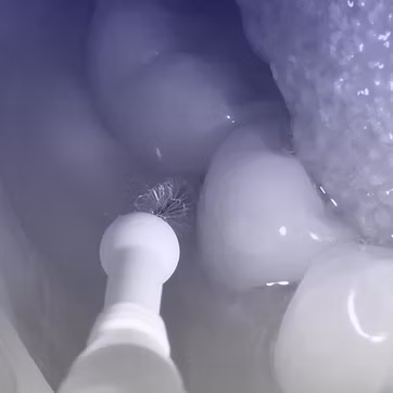 Професійна чистка зубів