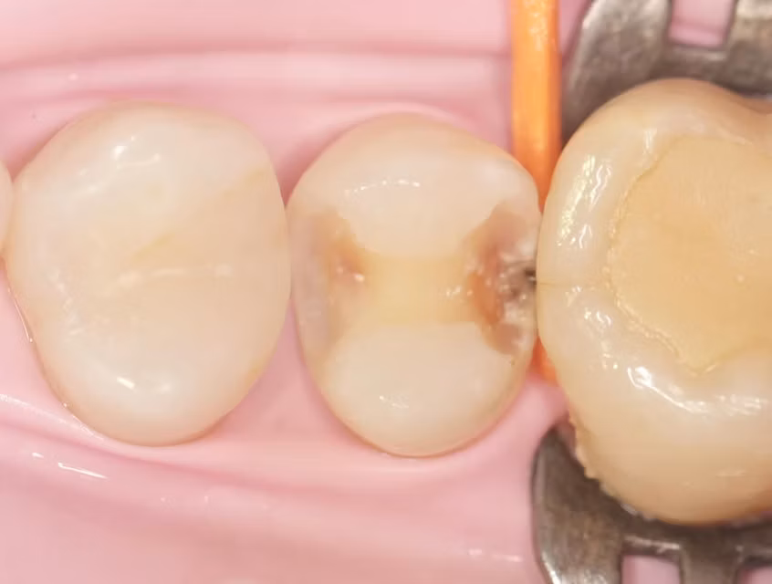 Результат лікування