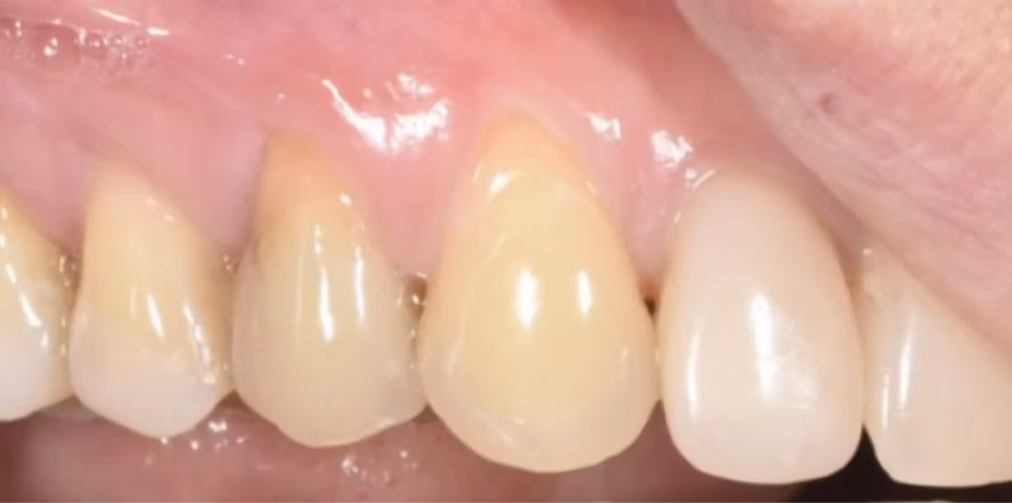 До лікування