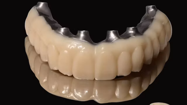 Тотальна реабілітація посмішки